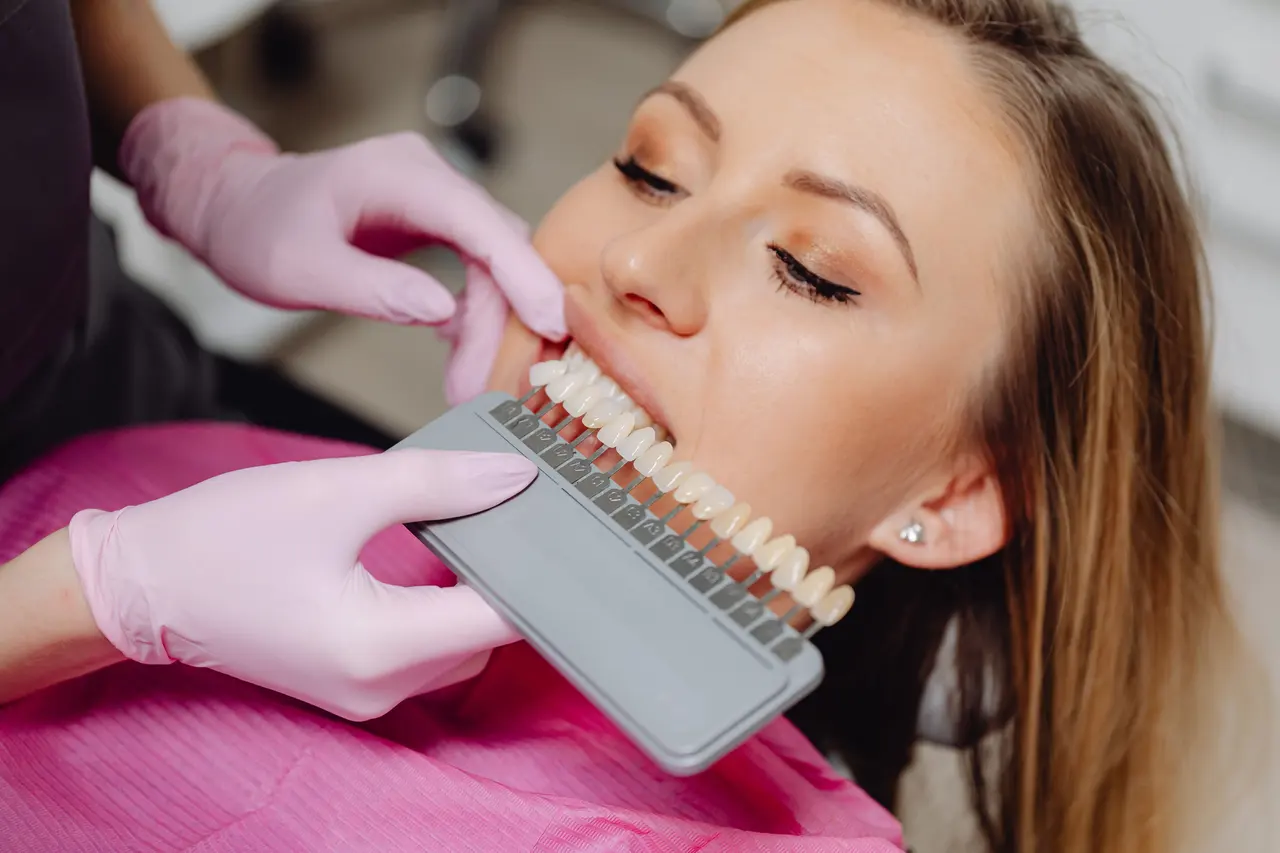 A patient having a tooth shade guide held against their smile